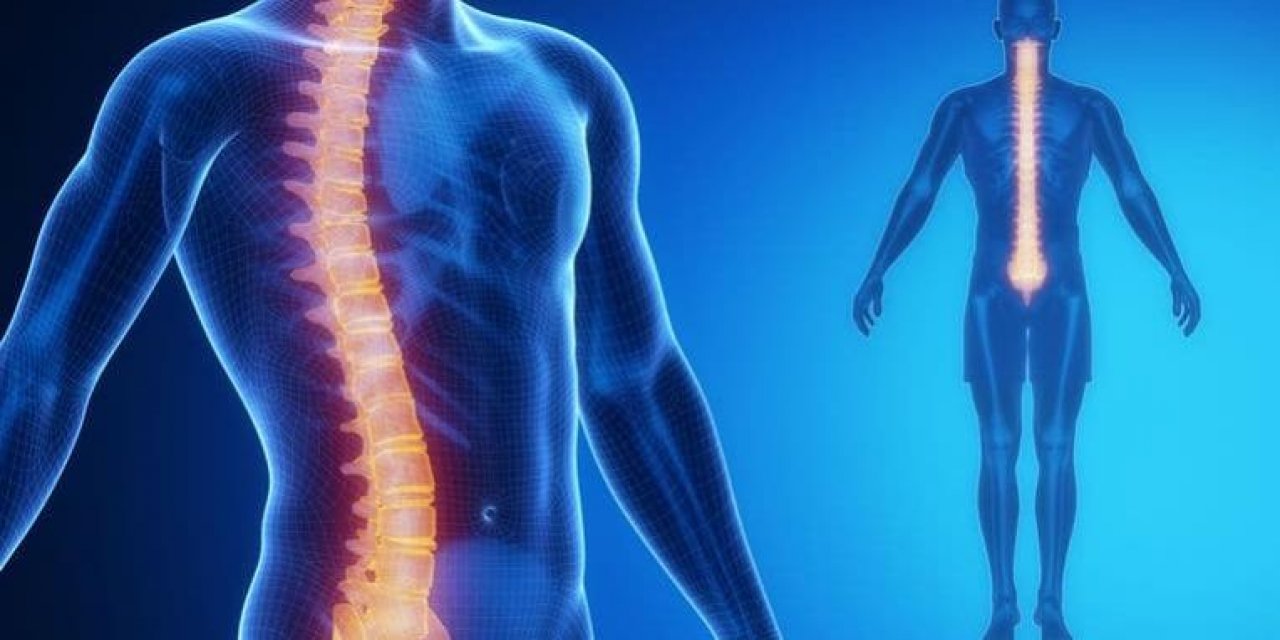 Skolyoz nedir belirtileri nasıl gözlemlenebilir?