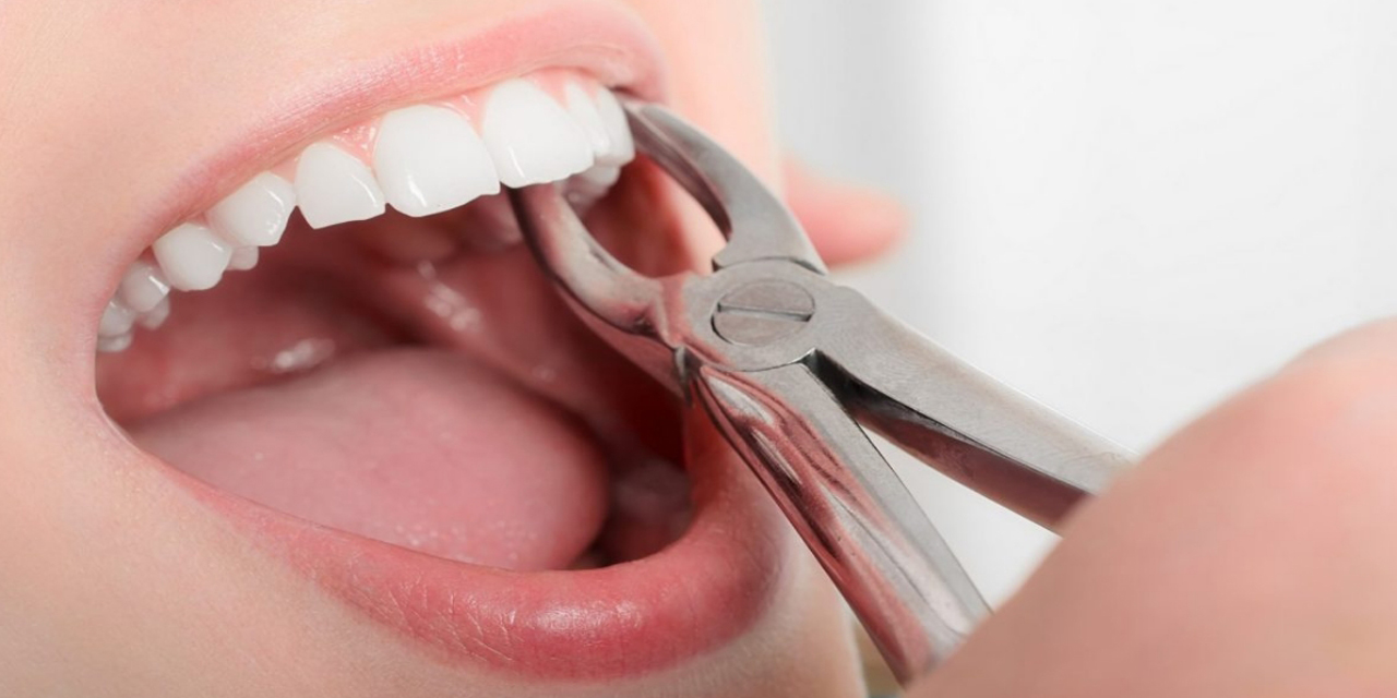 Ağız ve diş sağlığı tedavisi alma