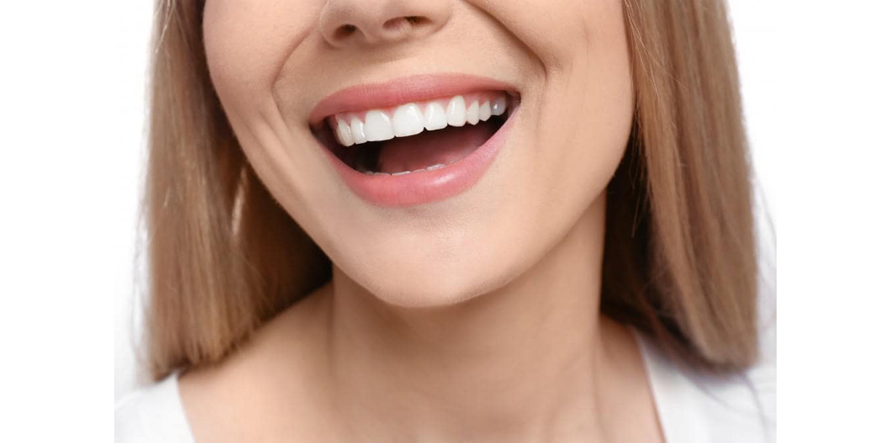 İstanbul'da gülüş tasarımı estetiği yapan klinik