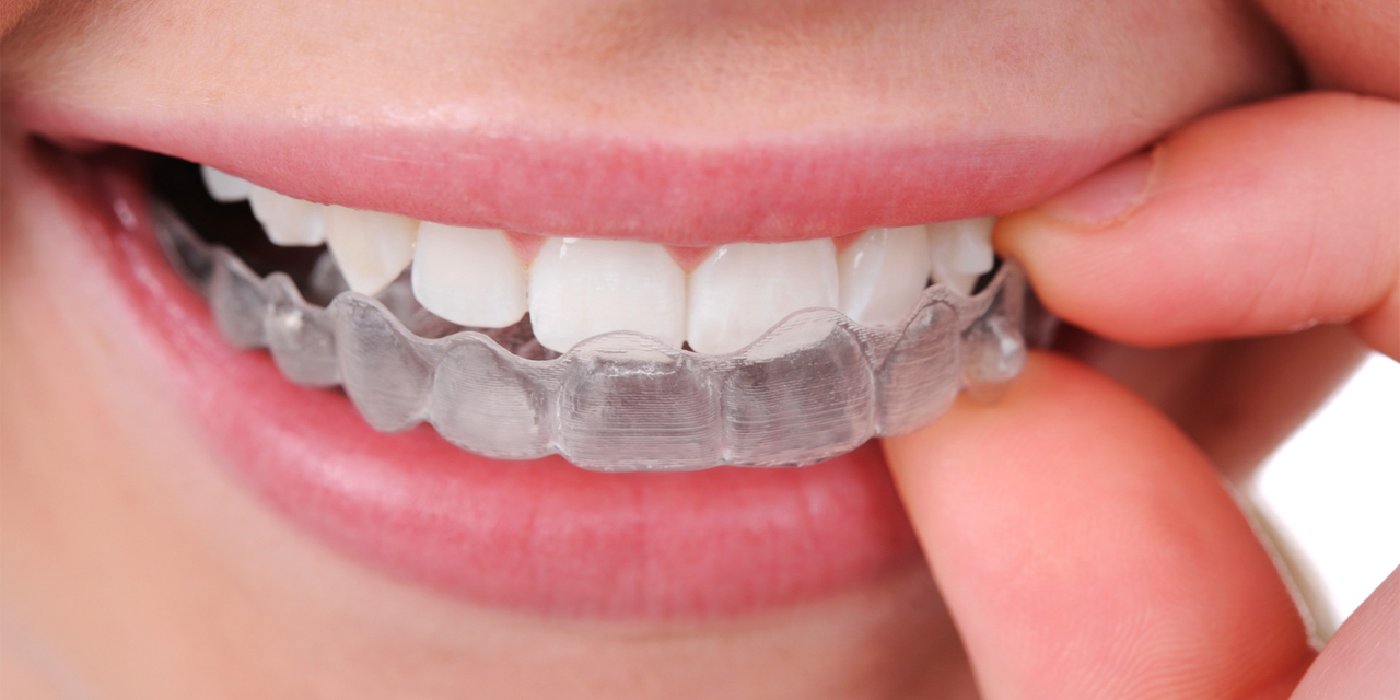 Ortodontik tedaviler ne kadar sürer?