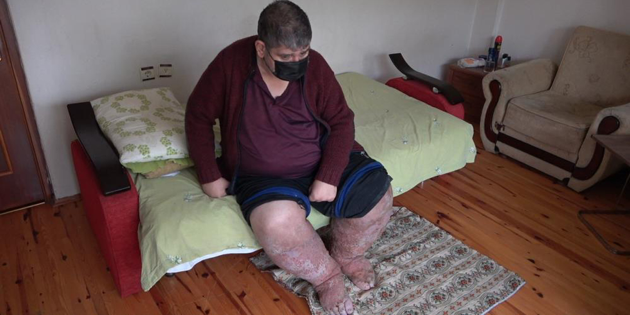 Sivrisinek, güvenlik görevlisinin hayatını kararttı