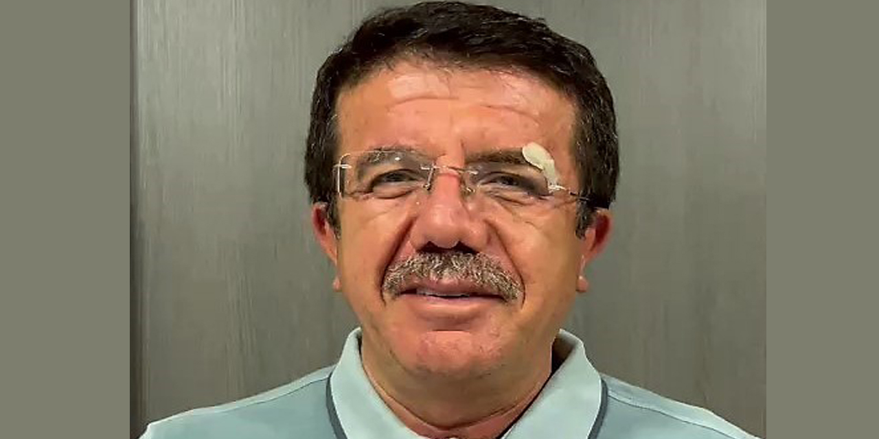 Kazada yaralanan eski Bakan Zeybekci: "Şu anda gayet iyi durumdayız"