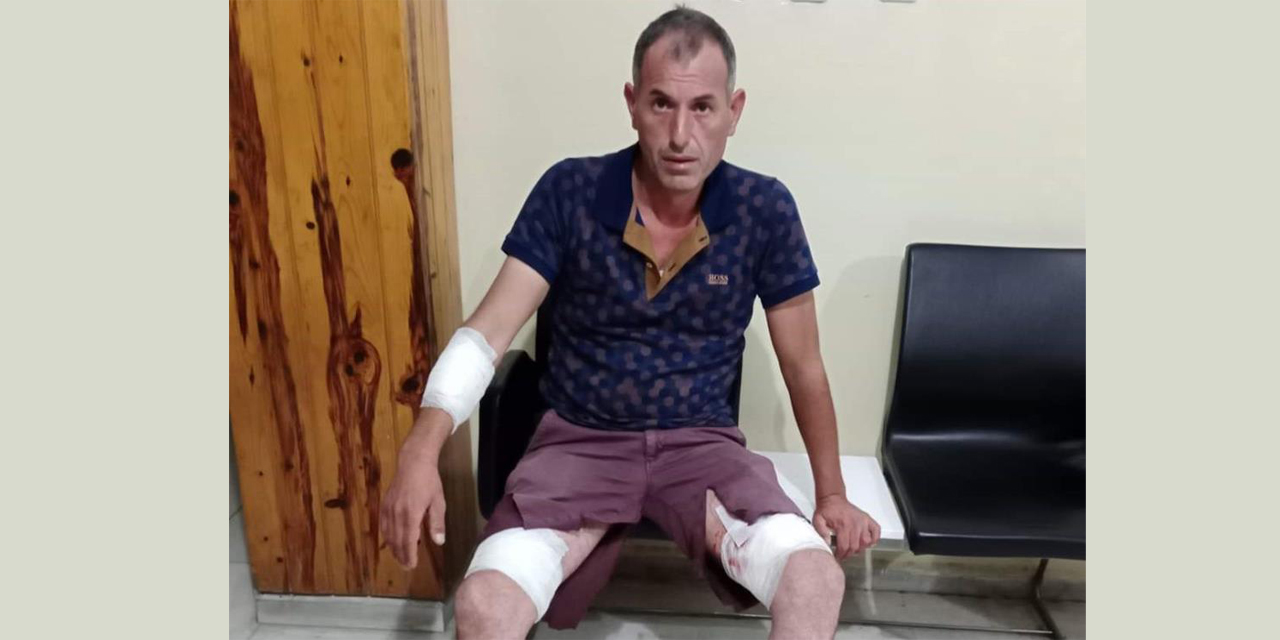 Sokak köpeklerinin saldırısına uğrayan Ersoy isyan etti