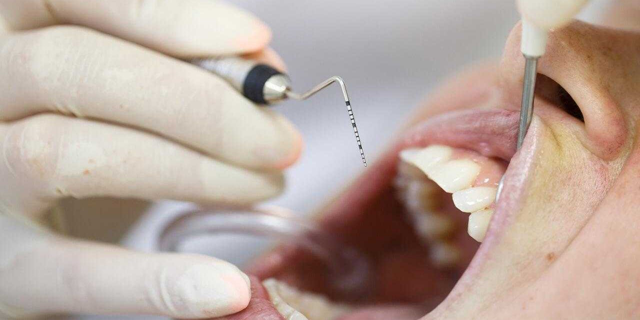 Diş eti tedavisi hakkında bilmeniz gerekenler