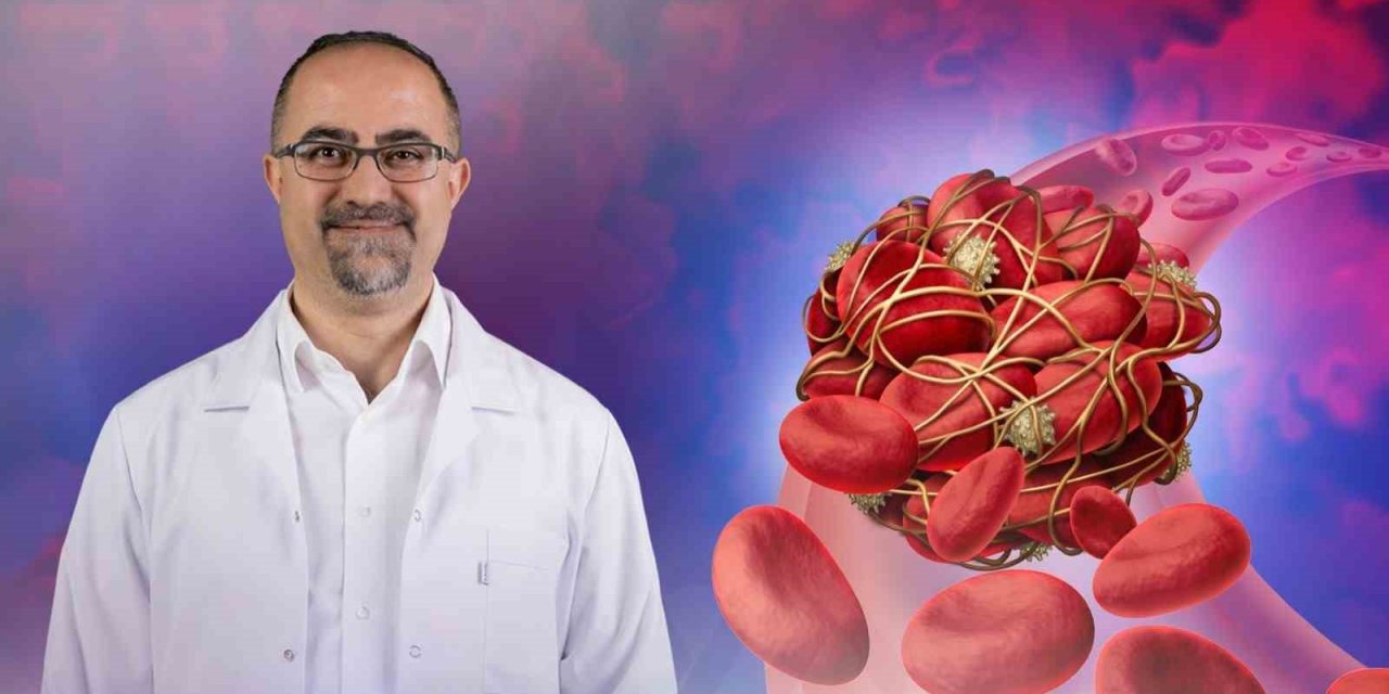 Tromboz hastalığı kanserin işareti olabilir