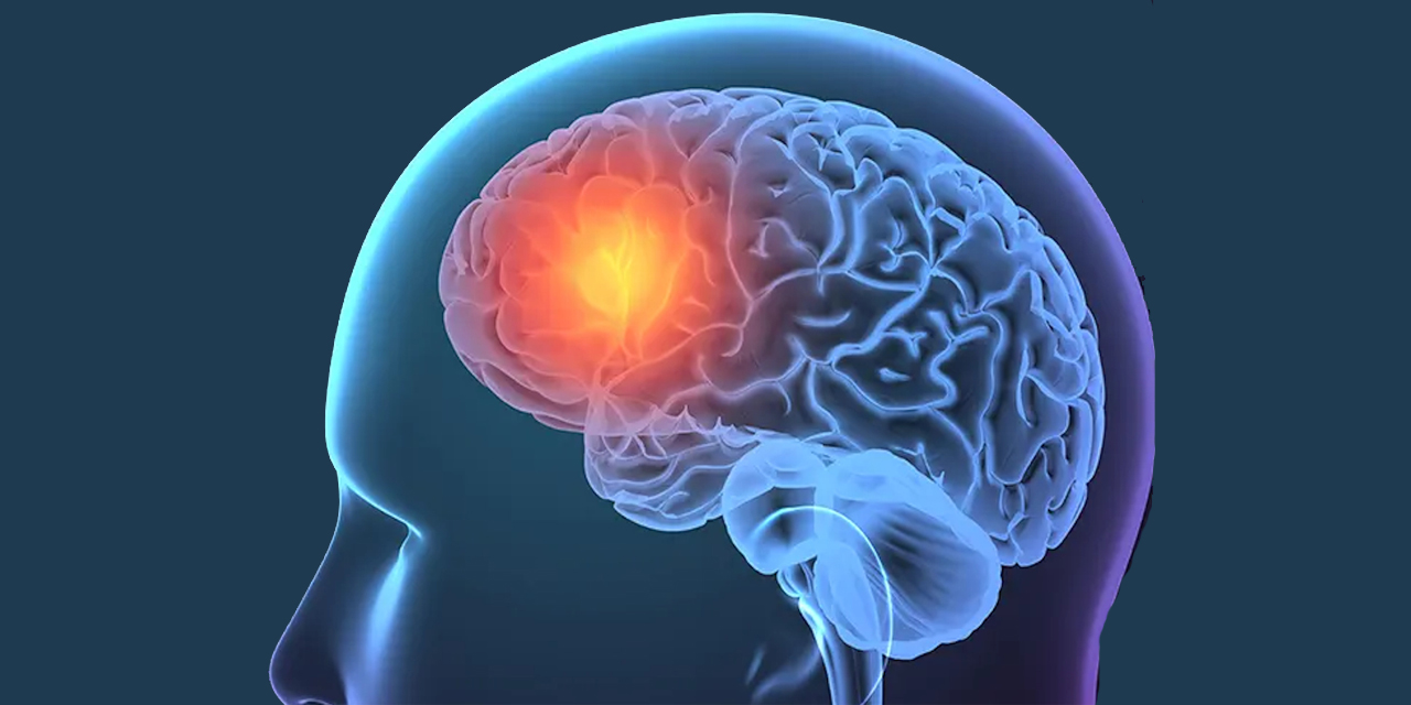 Beyin Cerrahisi İstanbul ve Beyin Pili