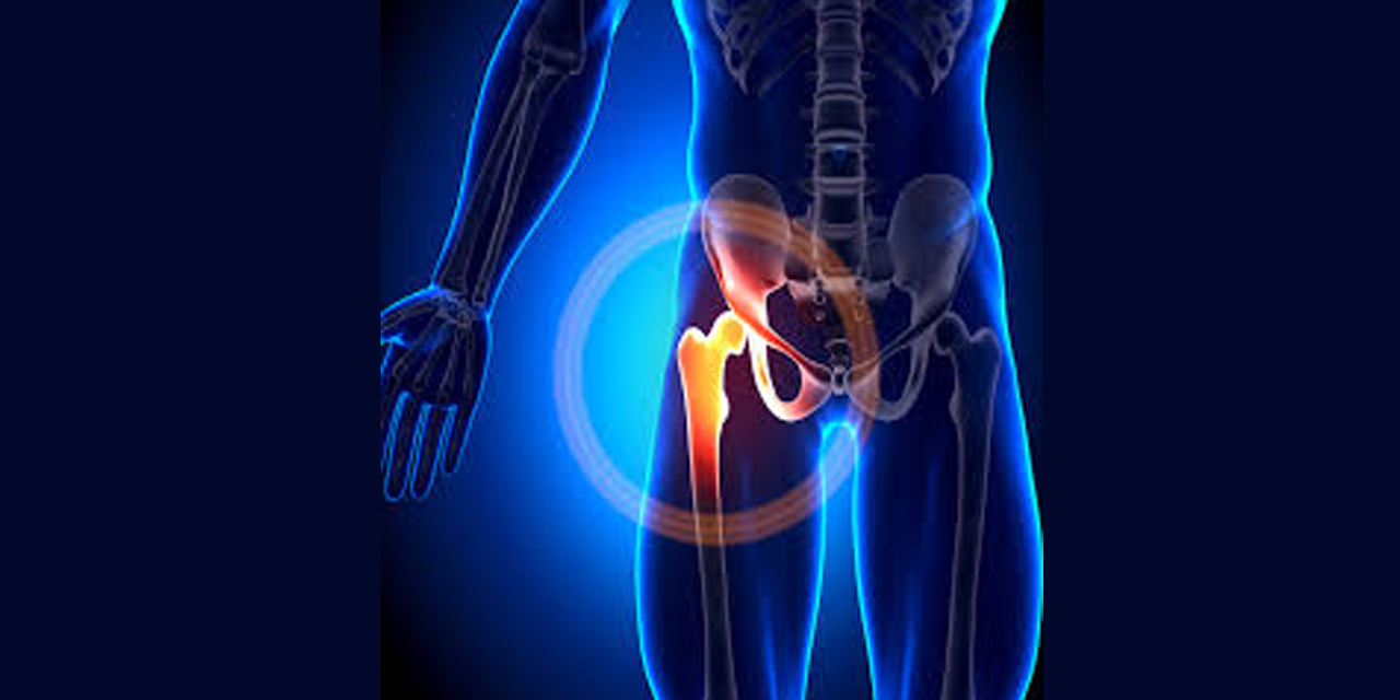 Avasküler nekroz nedir?