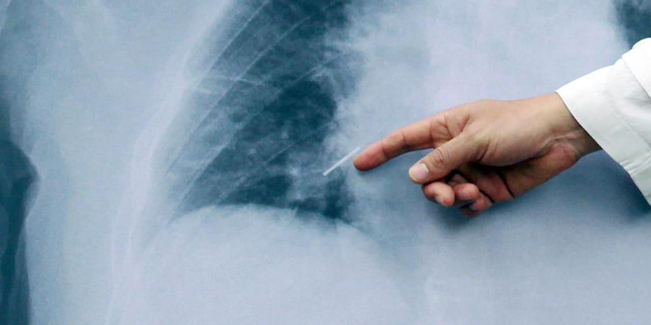 Uzmanlardan ‘sigara’ uyarısı