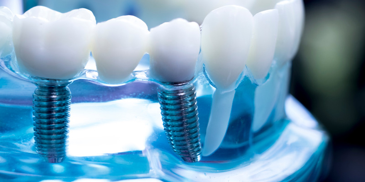 All On 4-6 Uygulamaları