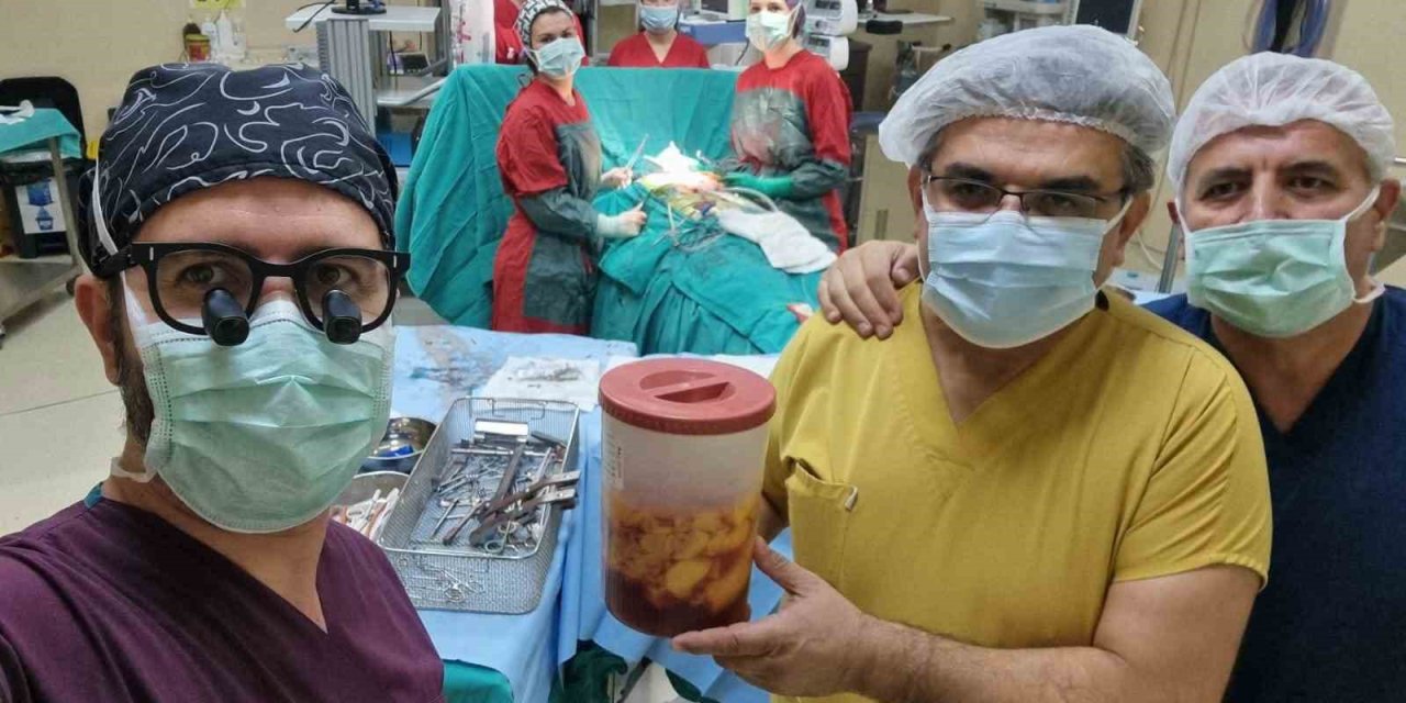 Kalpten beslenerek çevresini tamamen saran 1,1 kilogram yağ kitlesi görenleri hayrete düşürdü