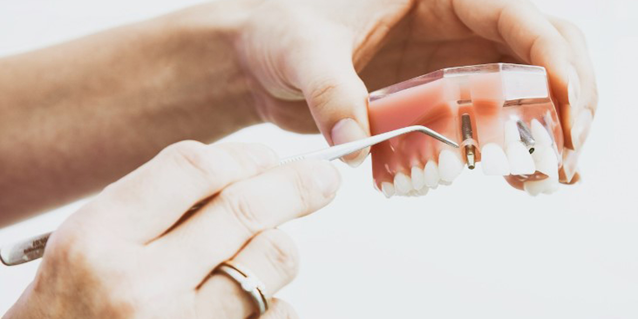 Siman Fulvarı Nedir?