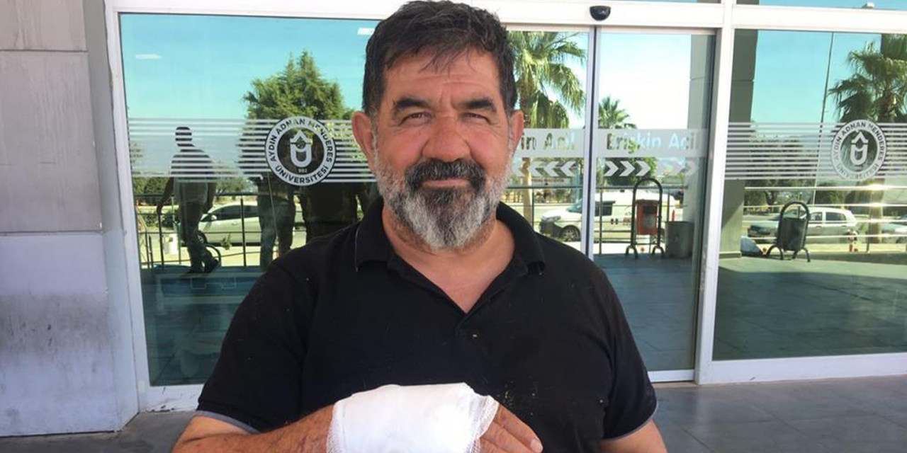 Acemi kasaplar hastanelik oldu
