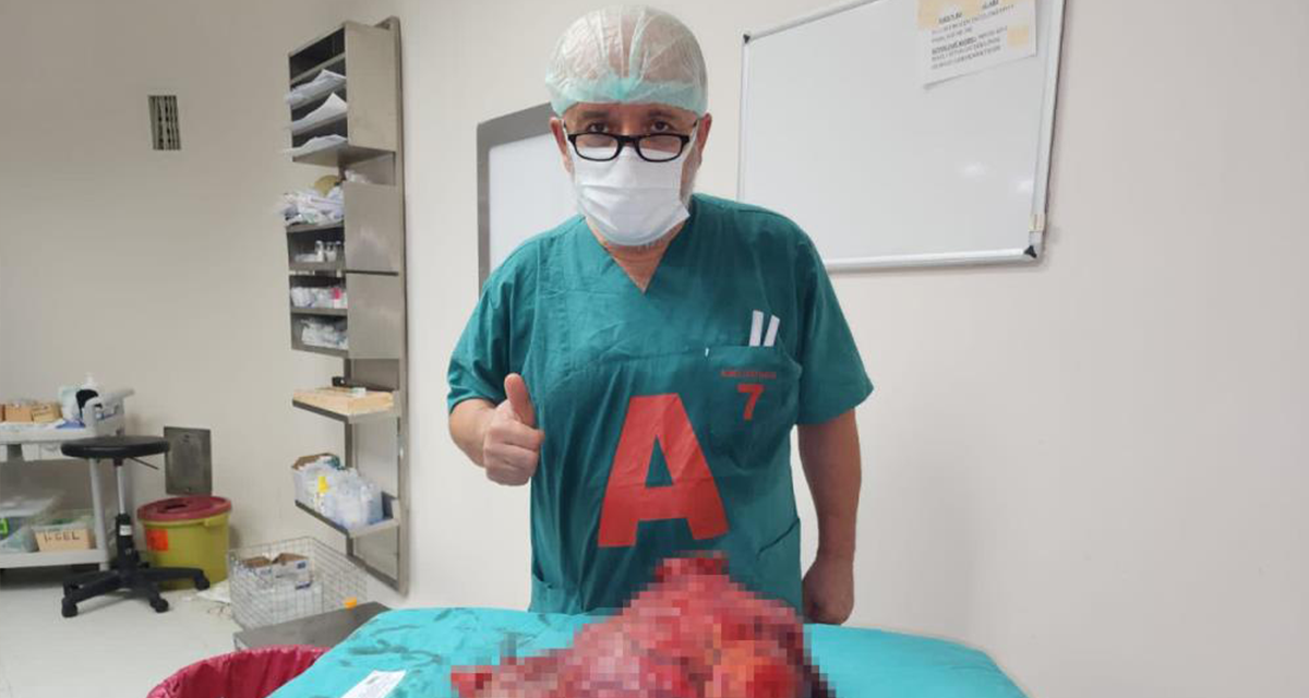 Karın ağrısı şikayetiyle gitti, 10 kiloluk dev tümör çıkartıldı