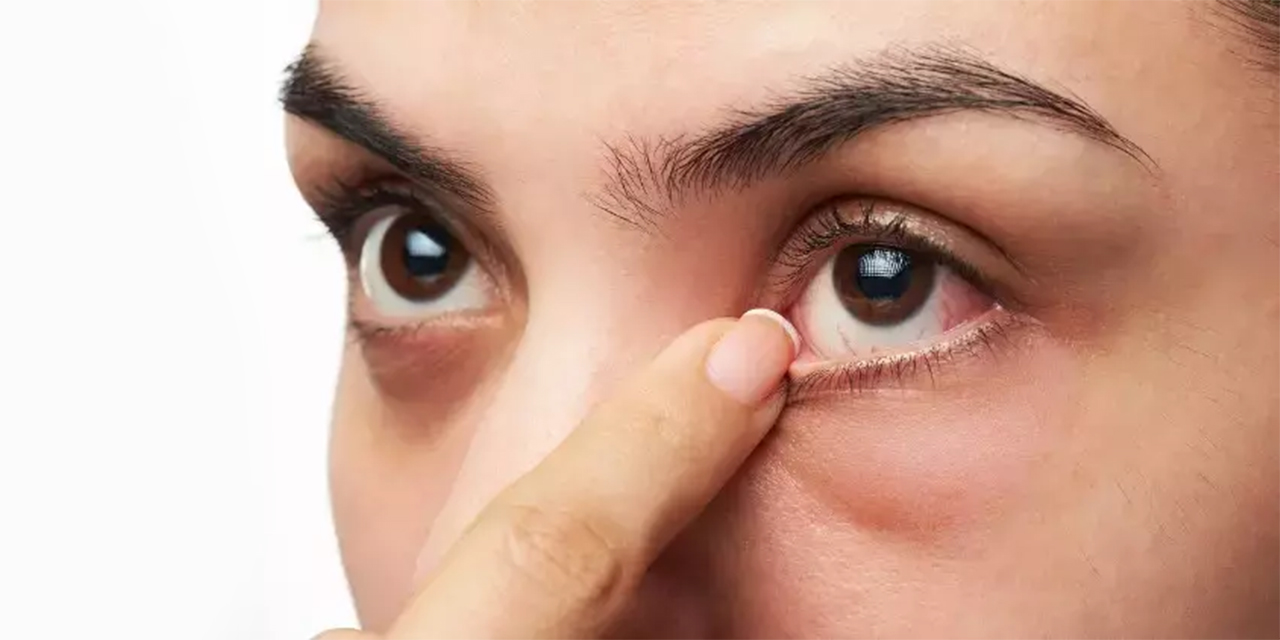 Güneş, klima ve havuz göz kuruluğunu artırıyor!