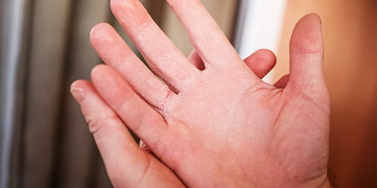 Kuru ellere özel yoğun nemlendirici krem: Cildiniz için maksimum koruma