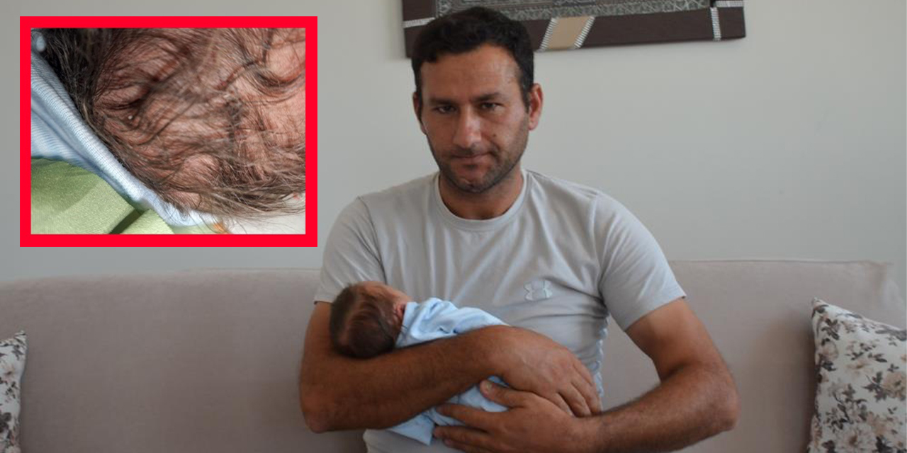 "Selim bebek başında 6 dikişle taburcu edildi"