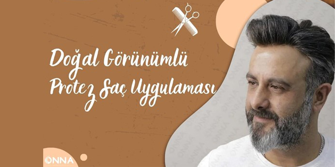 Doğal görünümlü protez saç uygulaması