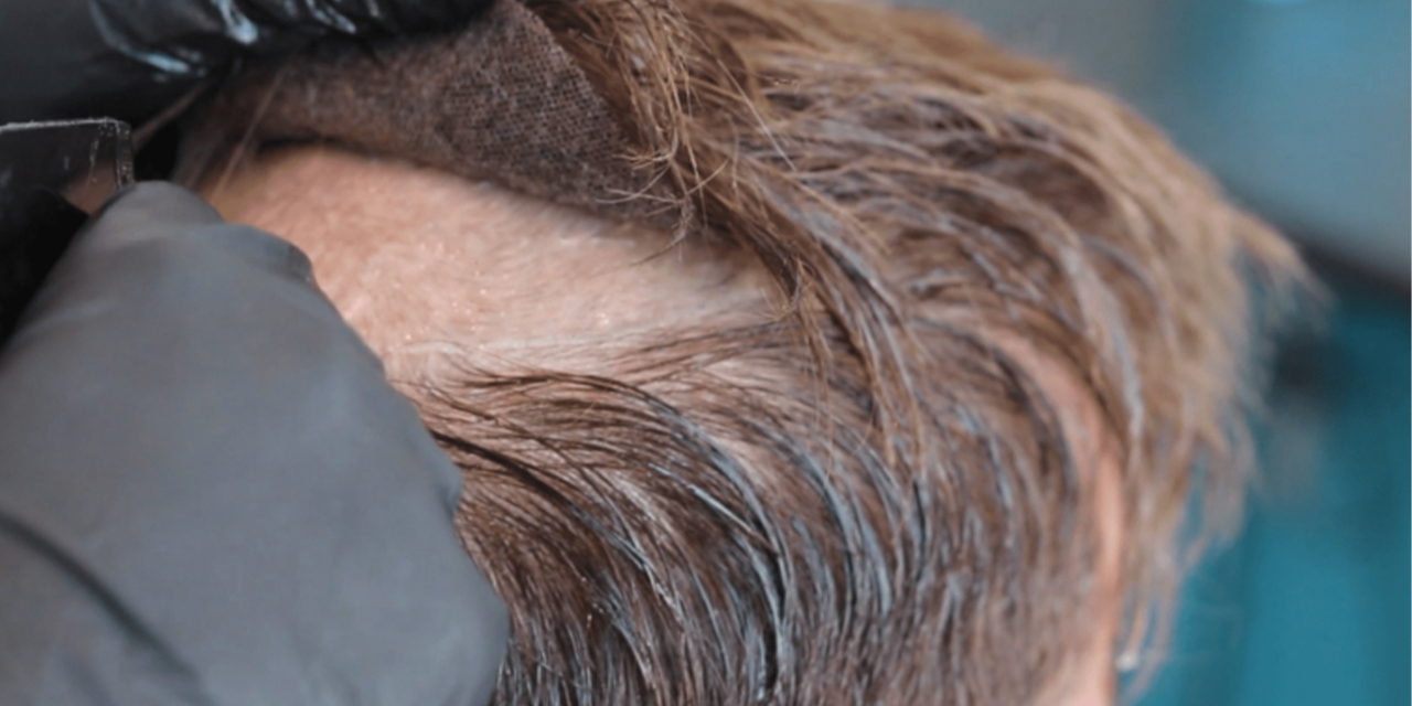 Protez saç: Doğal görünüm ve kendine güven