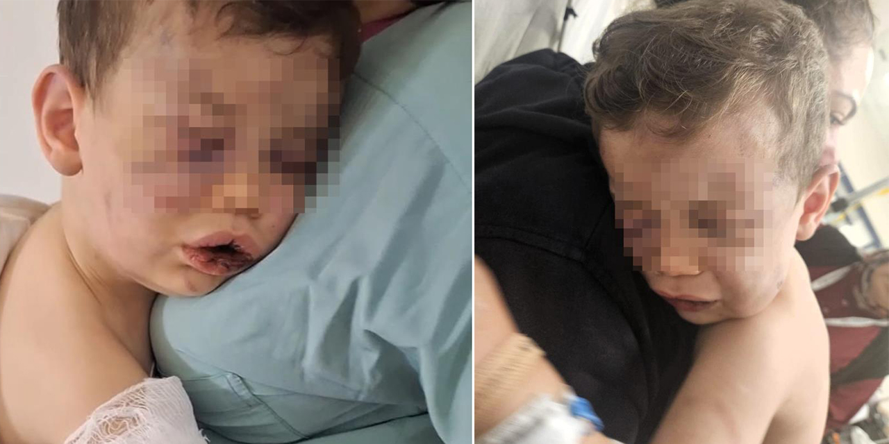 Darp sonucu hastanelik olan bebek devlet korumasına alınacak