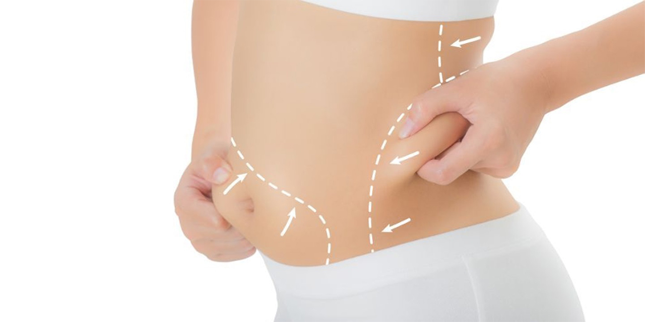 Fit ve şekilli bir vücut için liposuction trendleri