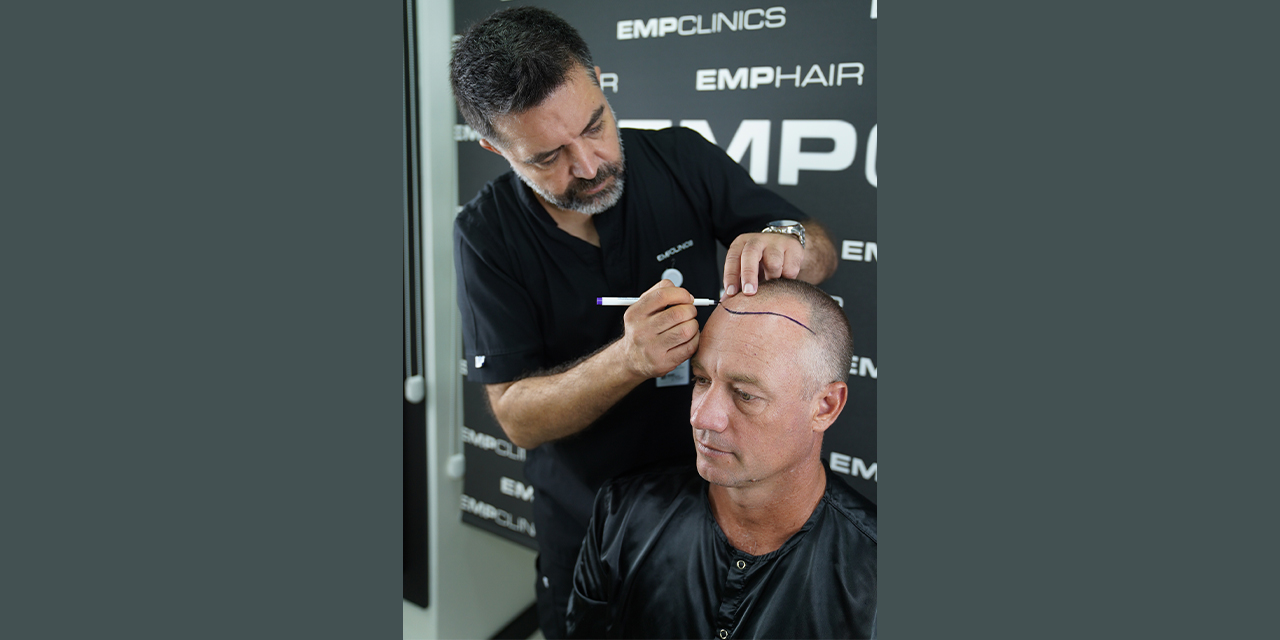 FUE Hair Transplant: The Gold Standard of Hair Restoration