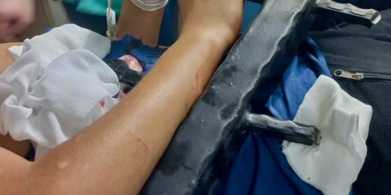 Ağaçtan düşen çocuk korkuluk demirlerine saplandı