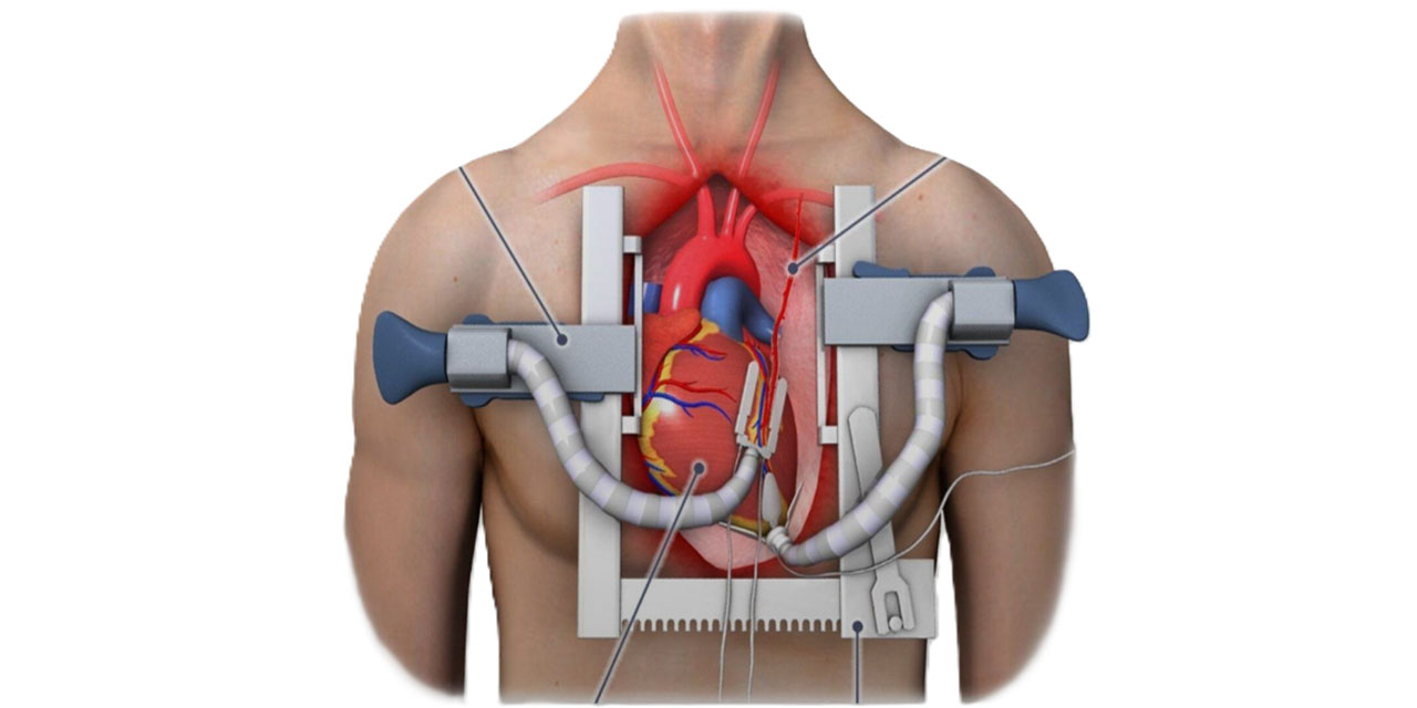 Anjiyo olmak korkutucu mu? İşlem öncesi ve sonrası bilmeniz gerekenler