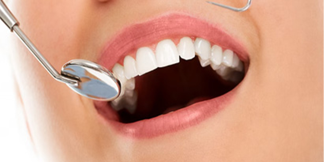 Diş estetiği gülüşünüzü nasıl dönüştürür?