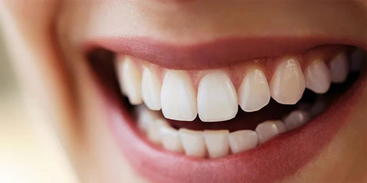 Diş estetiğinde “doğal gülüş” elde etmek için hangi yöntemler öne çıkıyor?