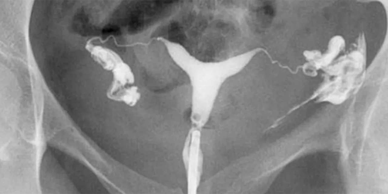 Rahim filmi tüplerin açıklığını gerçekten dakikalar içinde ortaya koyar