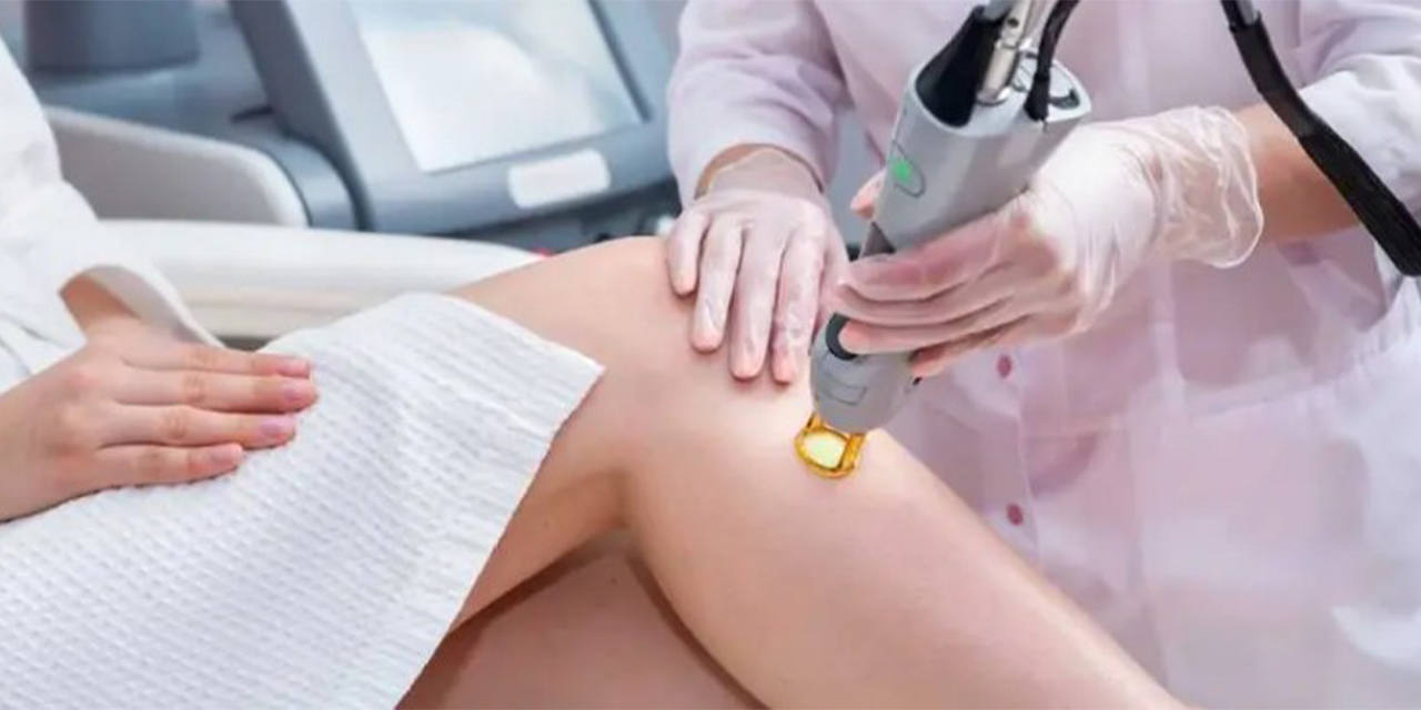 Lazer epilasyon nasıl çalışır ve kalıcı pürüzsüzlük için hangi faktörler önemlidir?