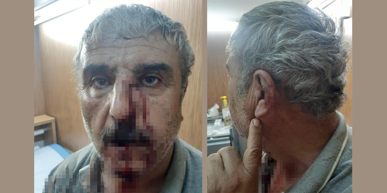 Aile hekimi ile emekli öğretmen yumruk yumruğa kavga etti