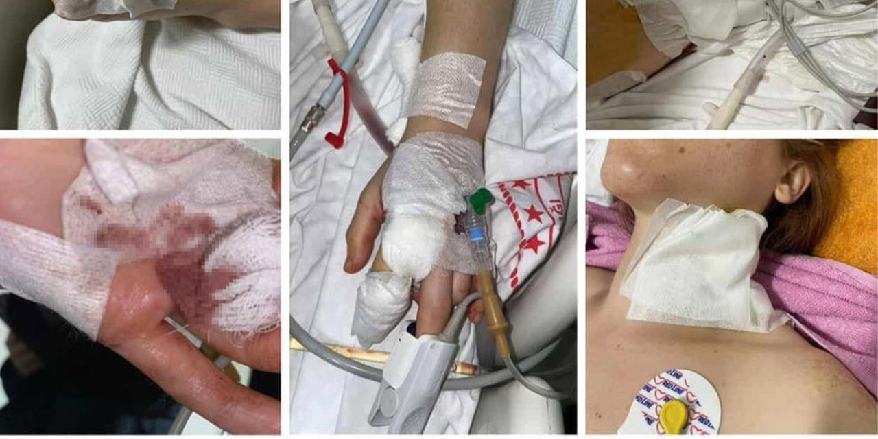 Eski kocası tarafından 11 yerinden bıçaklandı