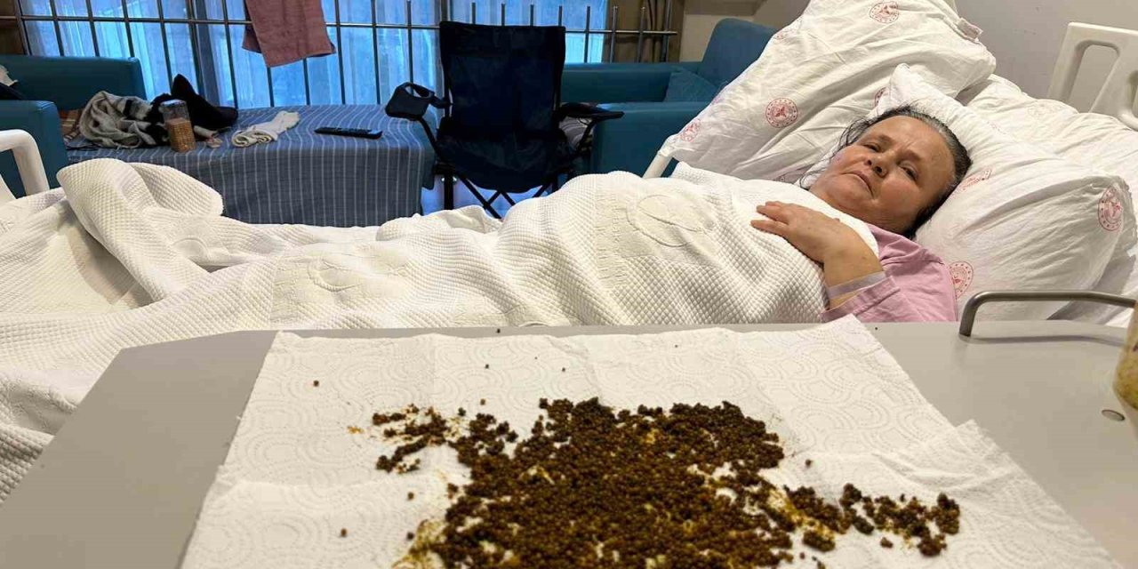 Hastadan çıkan taşları sayamadılar