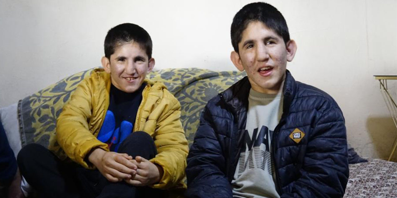 13 yaşındaki ikizler Kromozom 4q Delesyon Sendromu ile mücadele ediyor