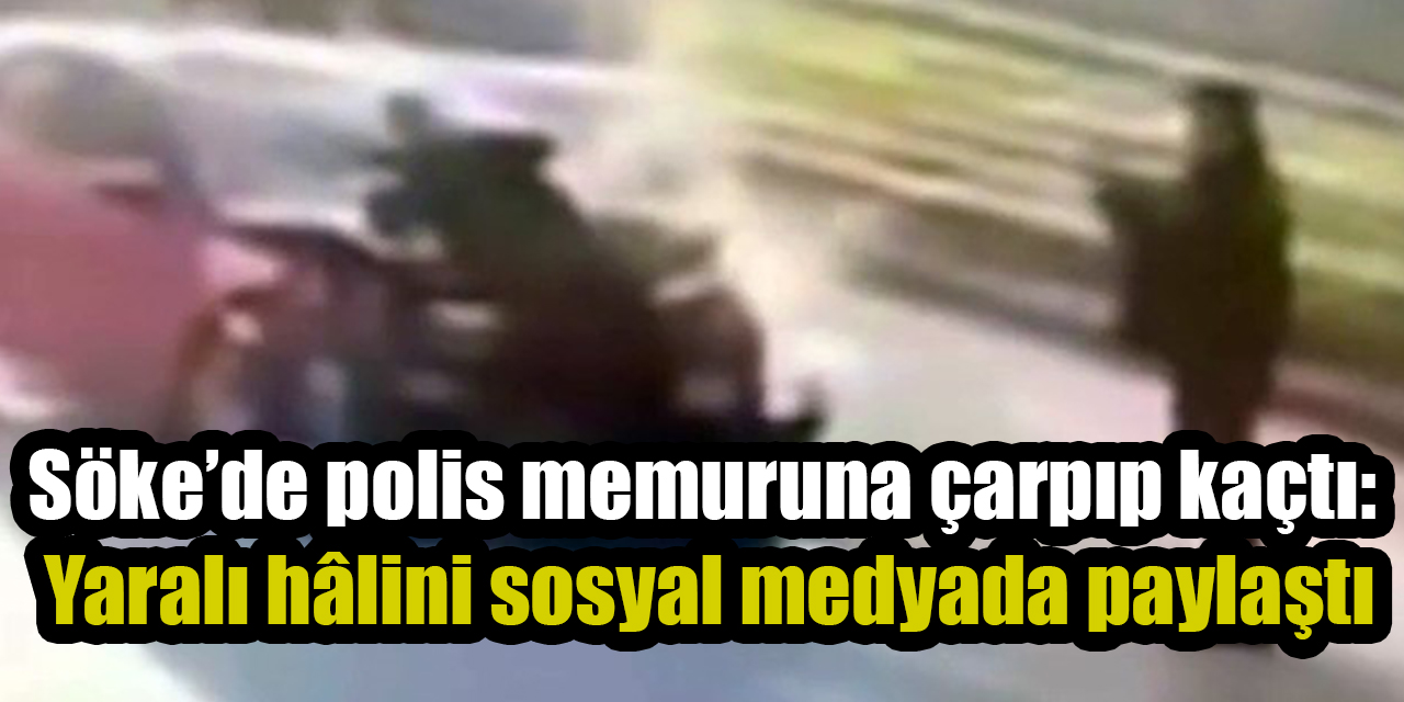 Söke’de polis memuruna çarpıp kaçtı:  Yaralı hâlini sosyal medyada paylaştı