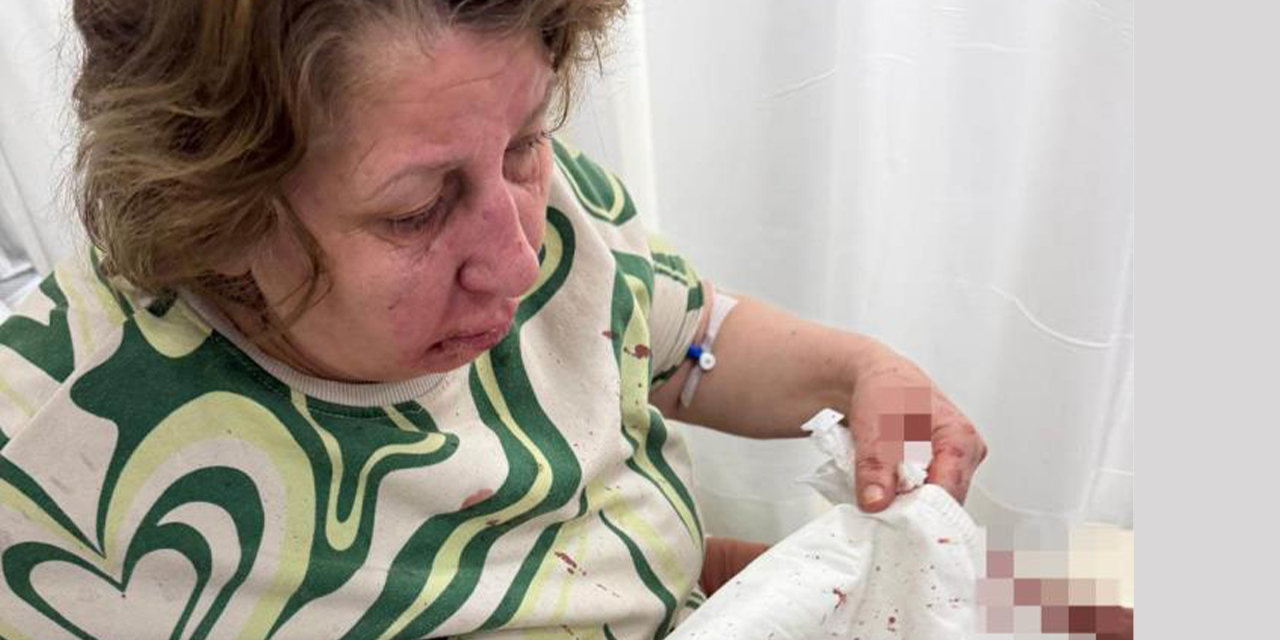 Komşu tartışması şiddete  dönüştü: Kadın darp edildi