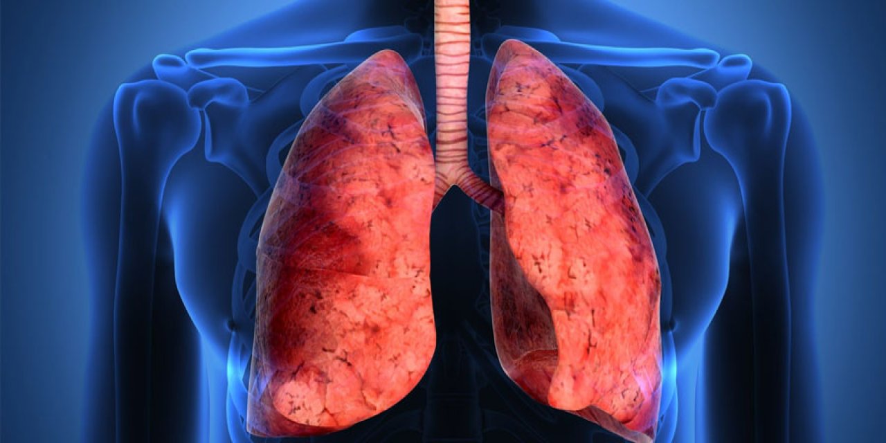 Bilgisayarlı Tomografi (BT): Hızlı ve Detaylı Görüntüleme