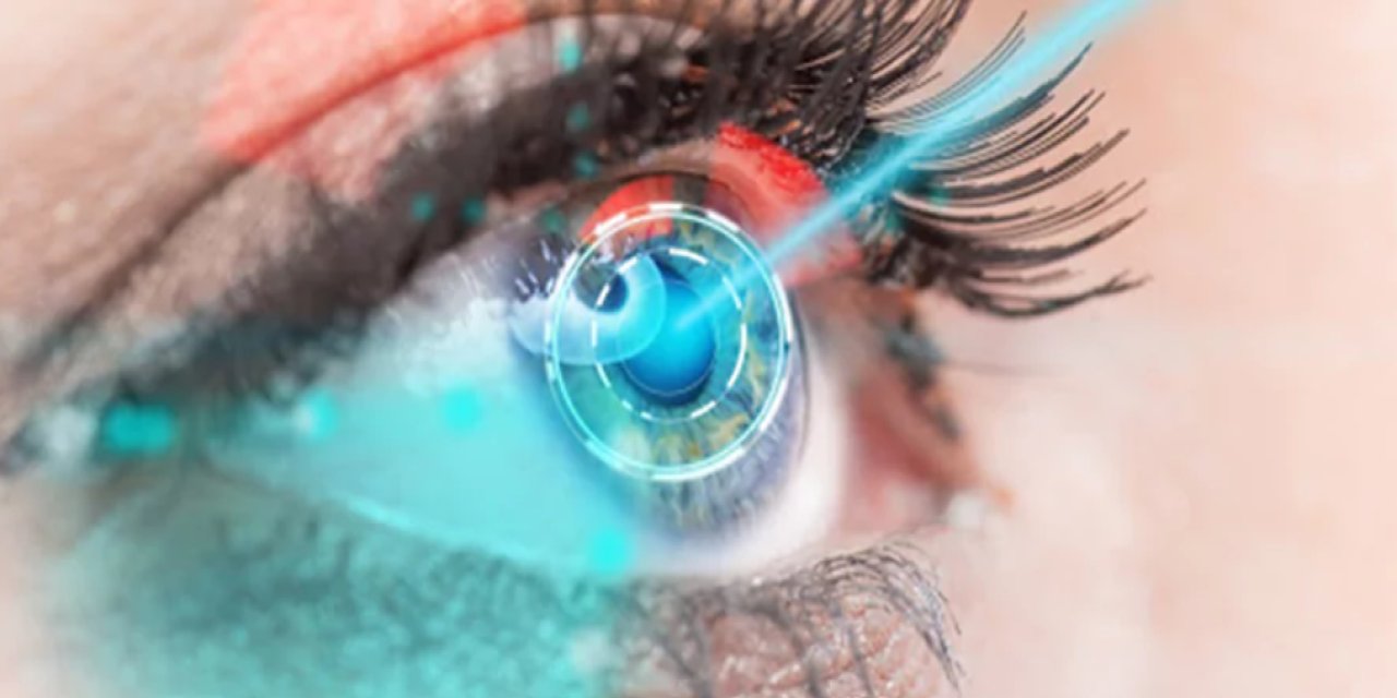 LASIK Göz Ameliyatı Nedir?