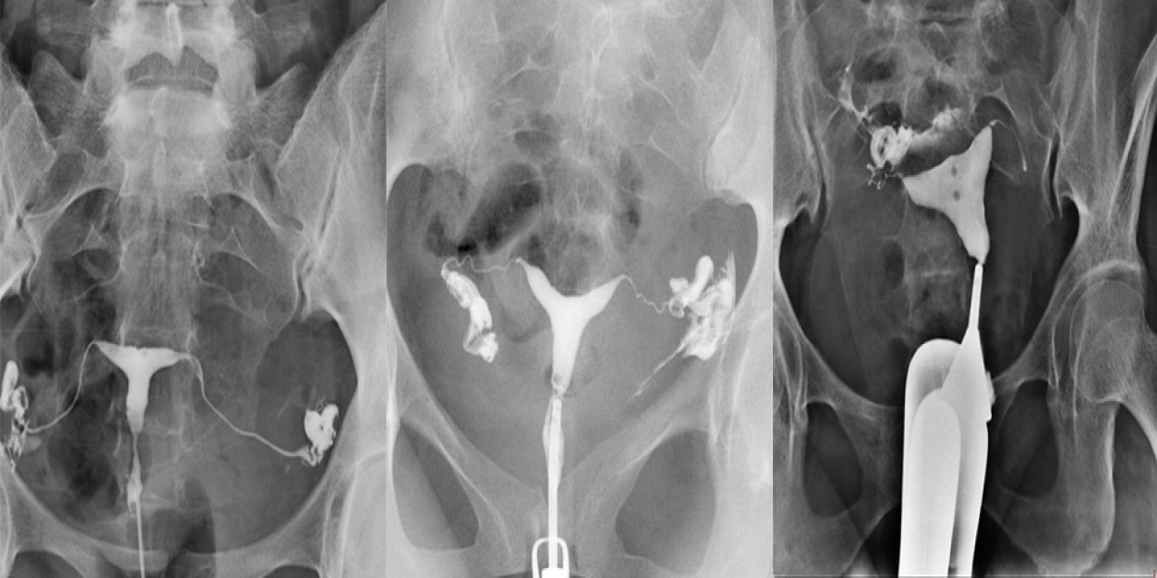 Rahim Filmi (HSG) Nedir?