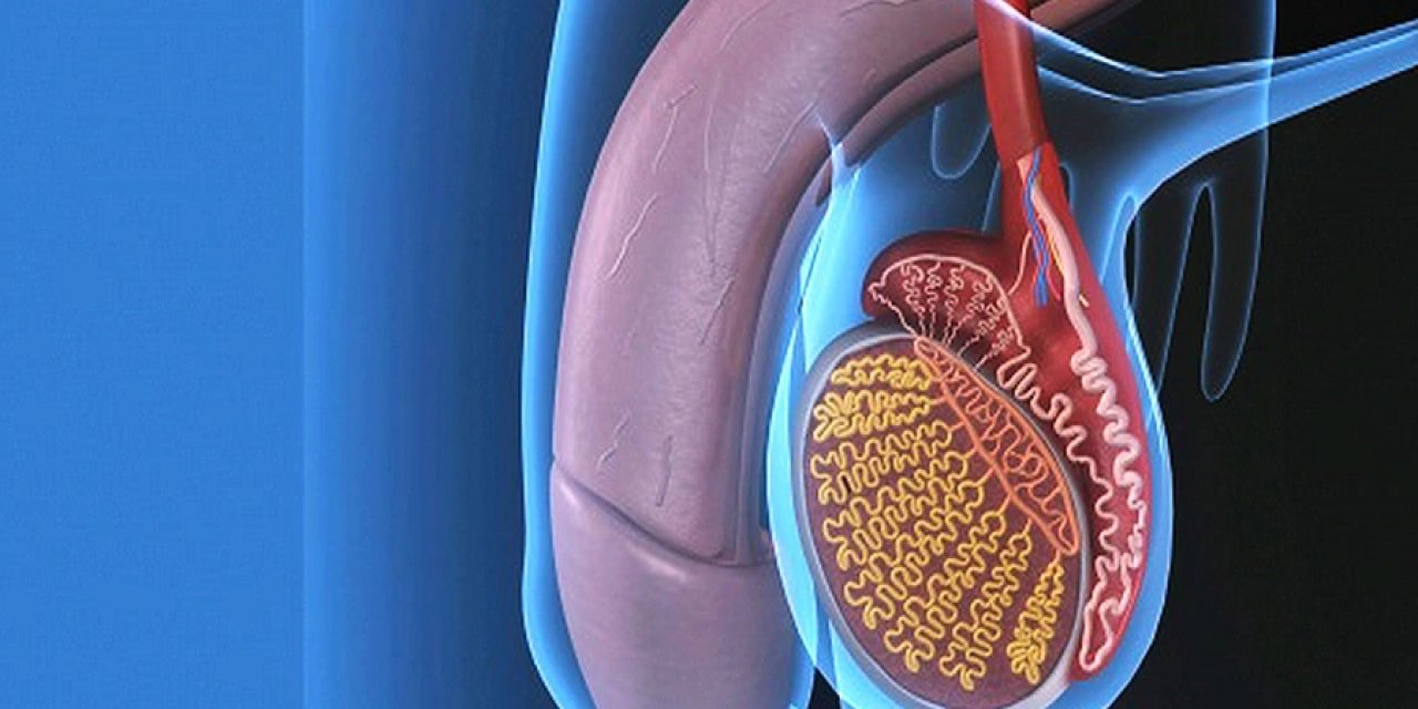 Varikosel Nedir? Erkek Kısırlığında Sessiz Tehlike