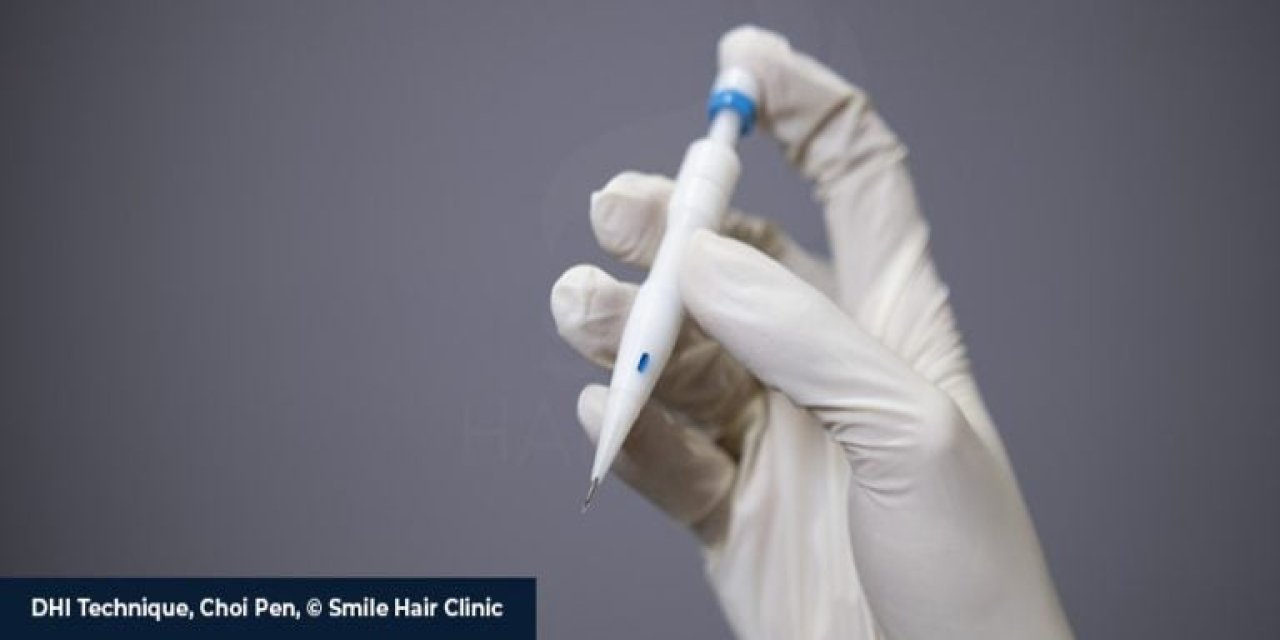 En İyi 10 Saç Ekimi Kliniği: Saçlarınıza Yeniden Hayat Vermek İçin Doğru Adresi Seçin