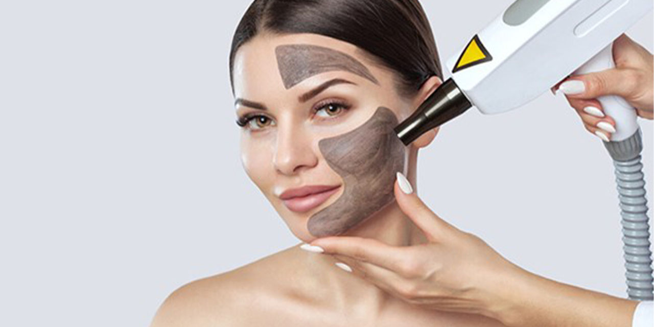 Karbon peeling nedir ve cilde ne gibi faydalar sağlar?