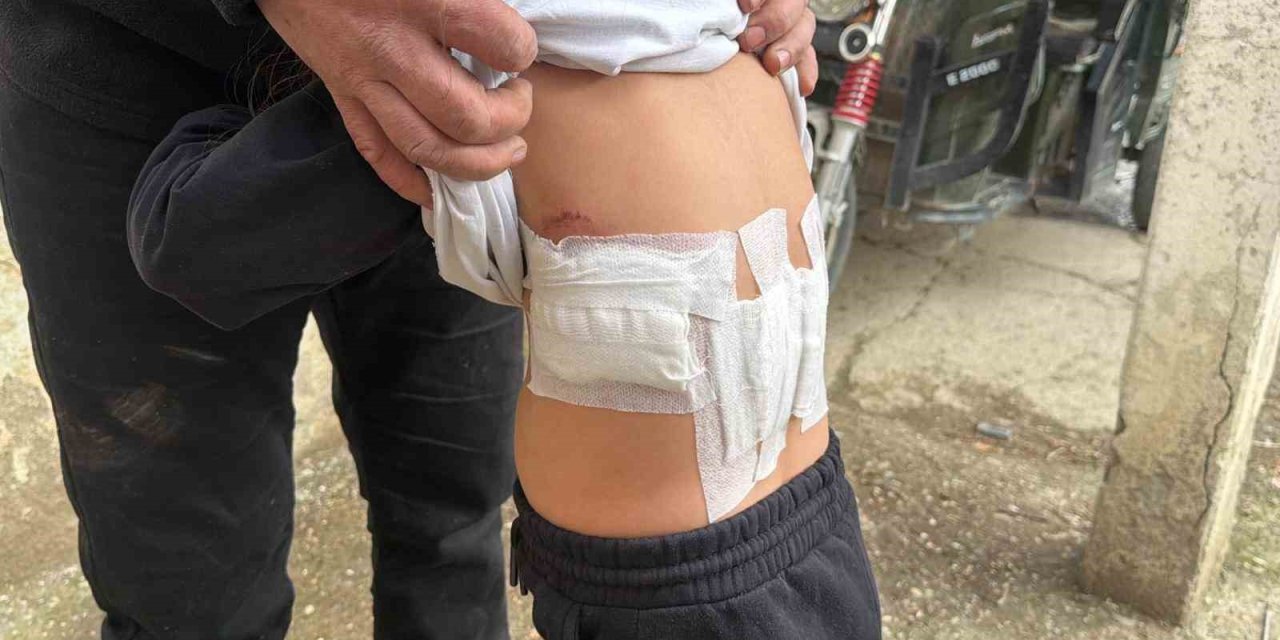 Saldırgan eşek evinin önünde oynayan 5 yaşındaki çocuğa kabusu yaşattı