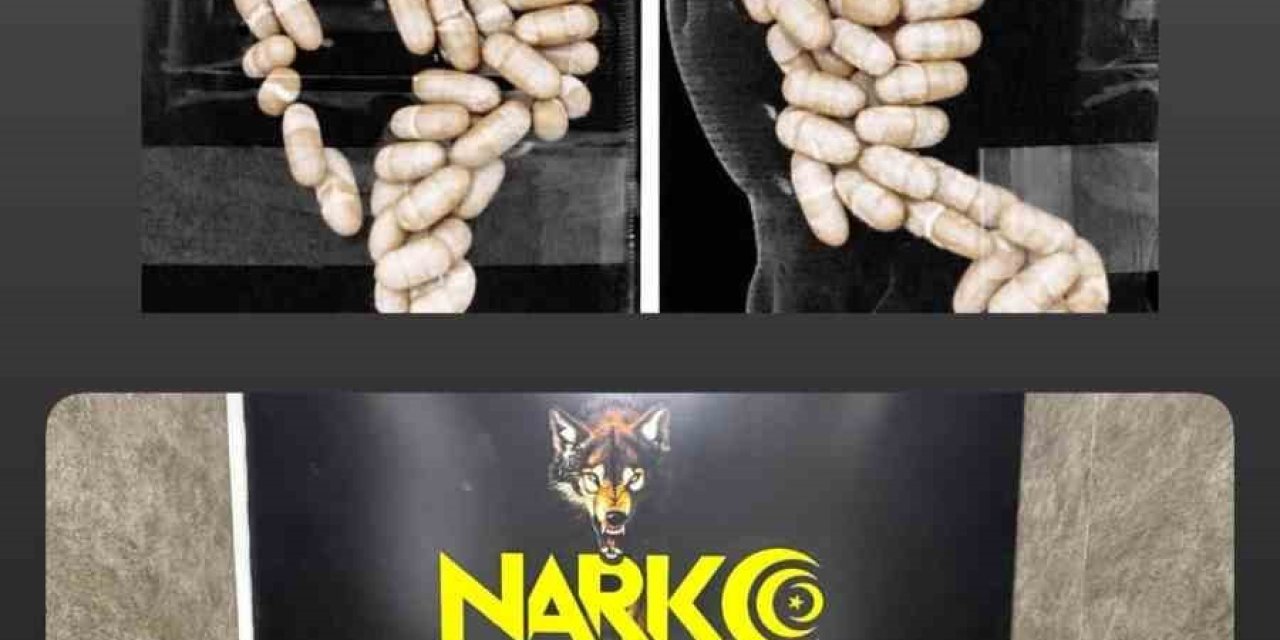 Midesinde uyuşturucu taşıyan şüpheliler tutuklandı