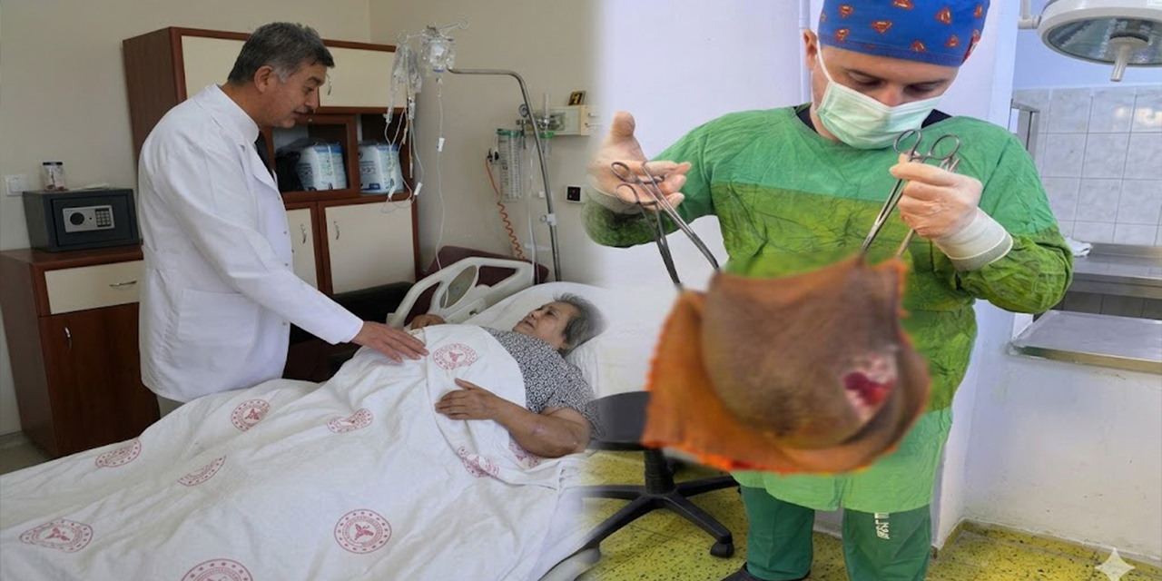 Karnından 40 kilogram kitle çıkarıldı