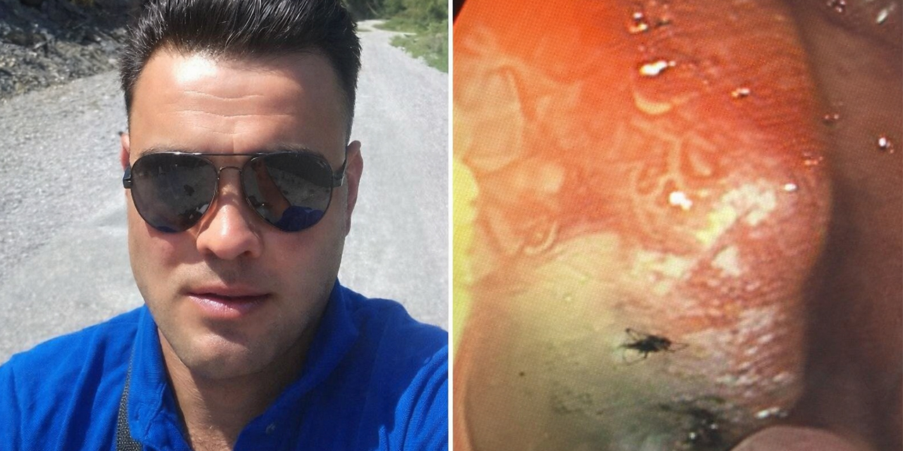 Aydın'da şaşkına çeviren olay: Midesine yapışan böcek ameliyatla çıkarıldı