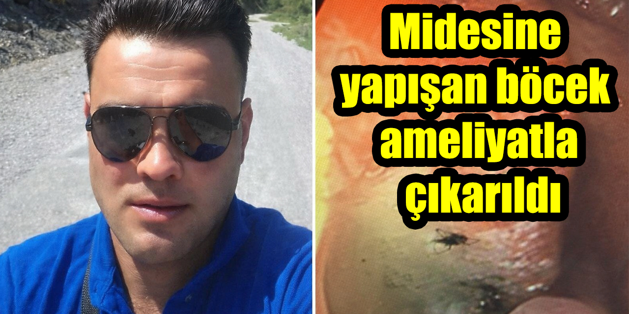 Aydın'da şaşkına çeviren olay: Midesine yapışan böcek ameliyatla çıkarıldı