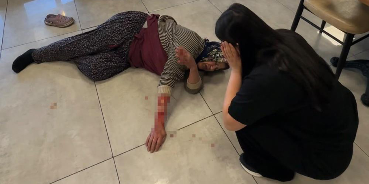 Köpek saldırısında kadının kolu koptu