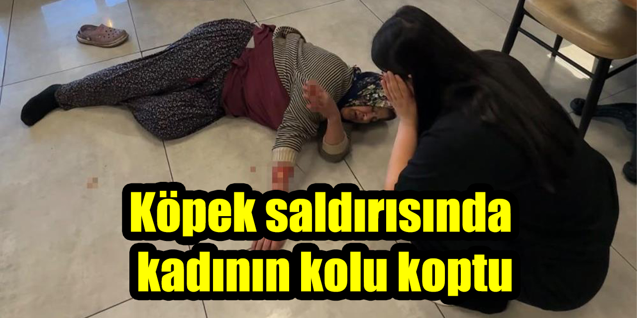 Köpek saldırısında kadının kolu koptu
